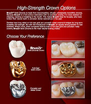 BruxZir Crowns & Bridges brochures